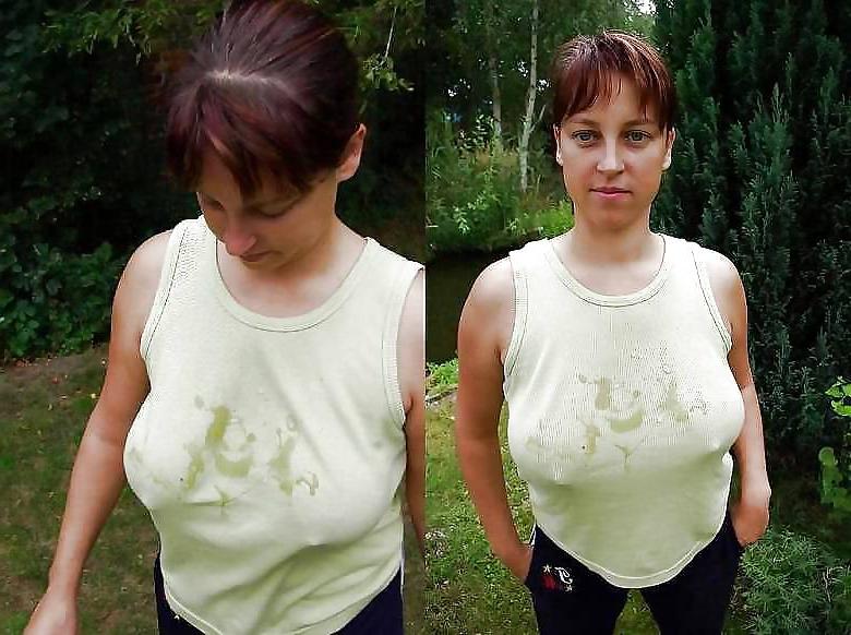 25P Areolas Breast