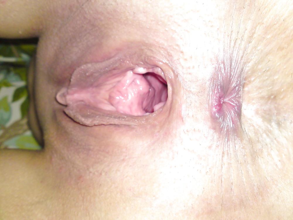 5P Close up