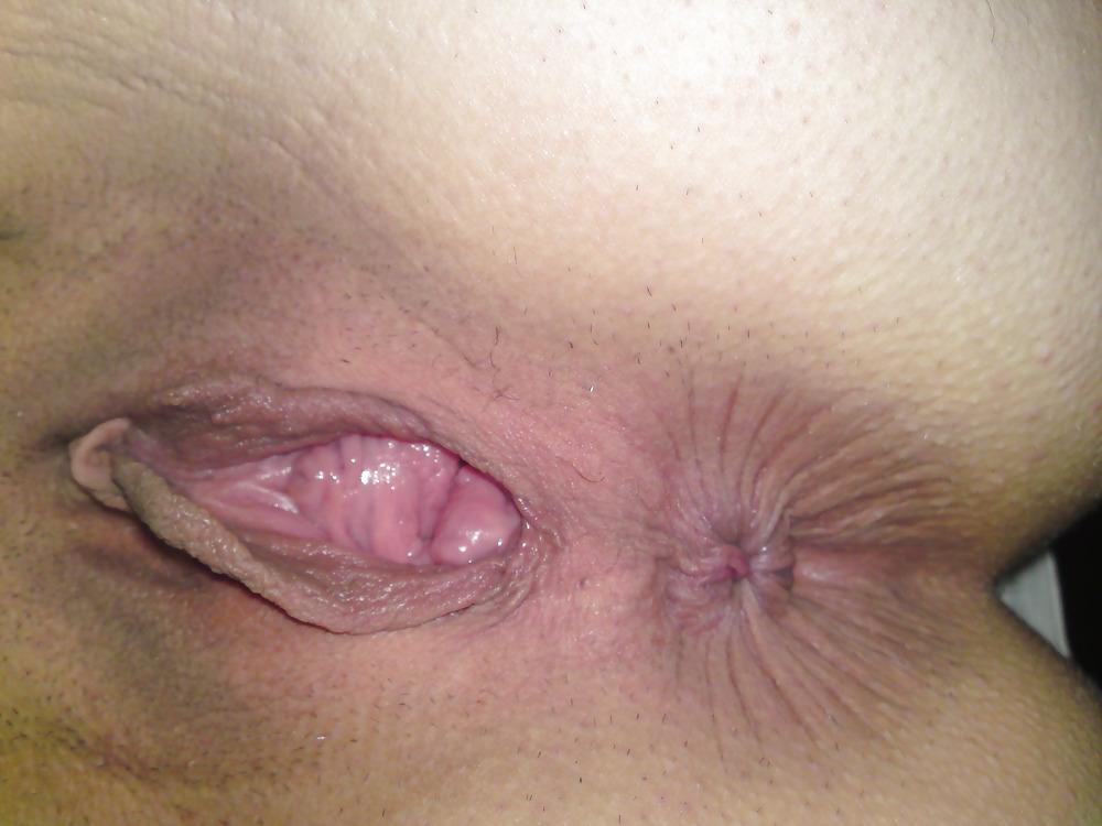 5P Close up