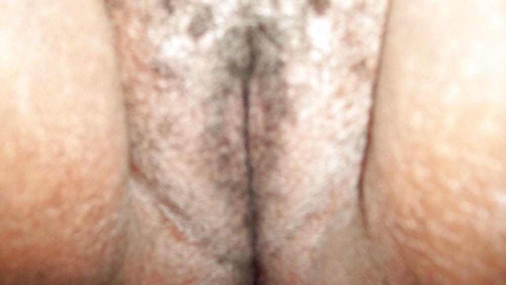 15P BBW Mental Case LaToya