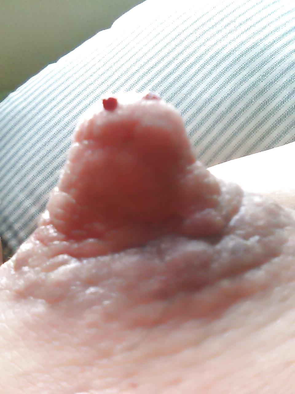 17P Damaged nipples! !!
