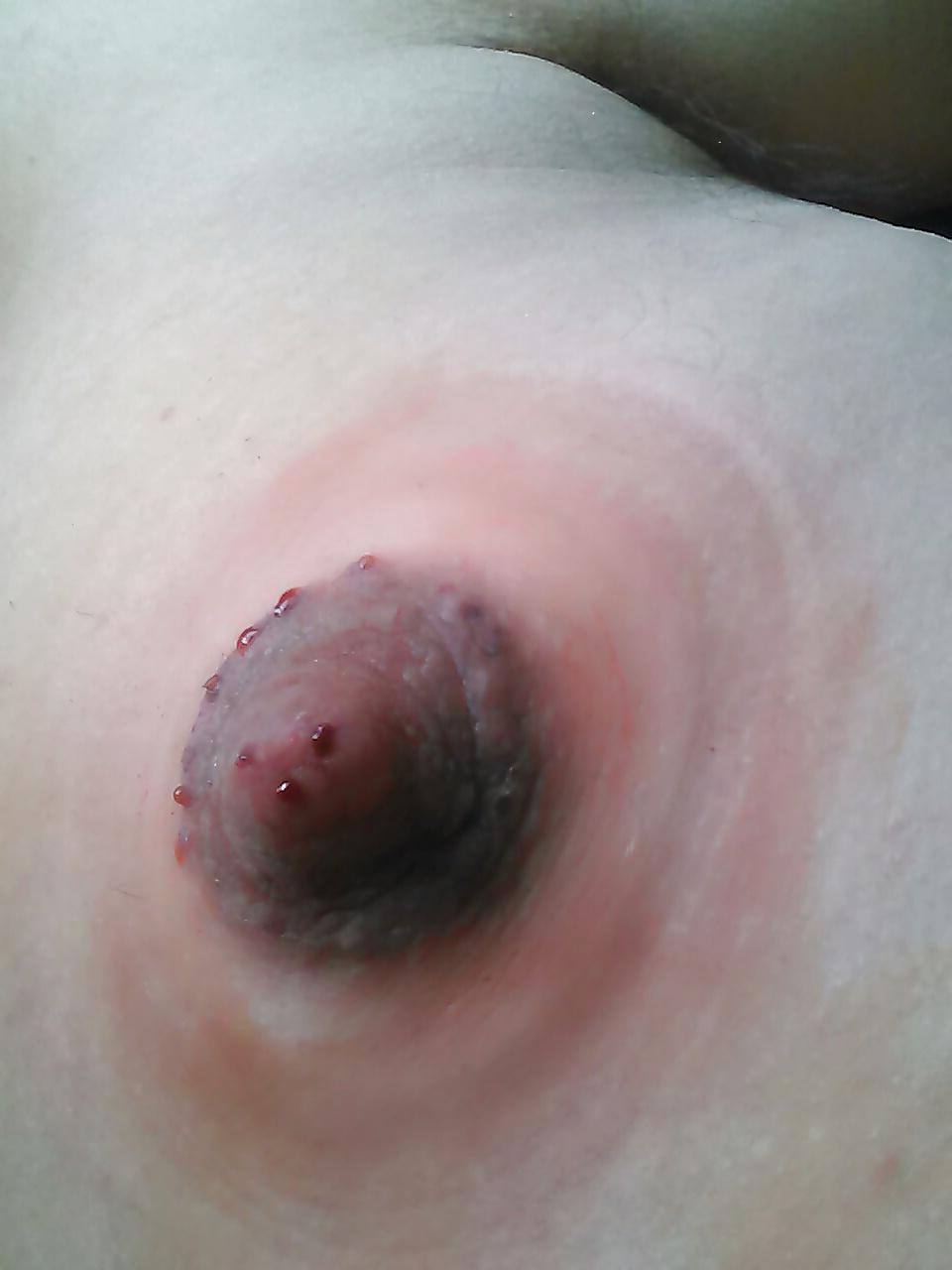 17P Damaged nipples! !!