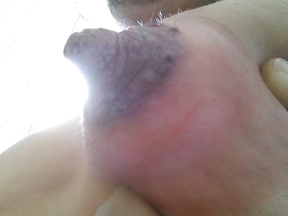 17P Damaged nipples! !!