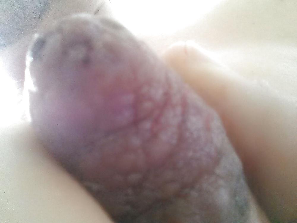17P Damaged nipples! !!