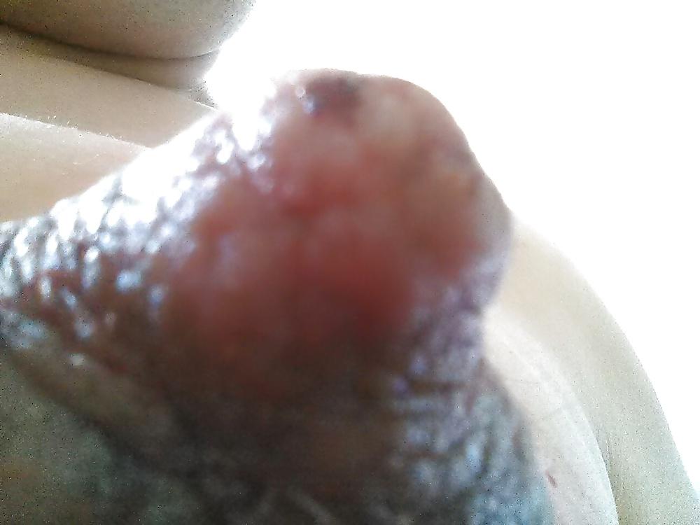 17P Damaged nipples! !!