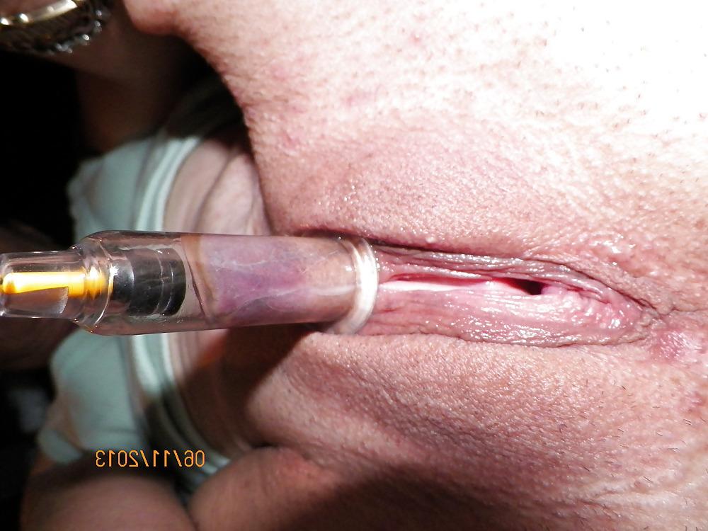 25P Pumped clit n nipples