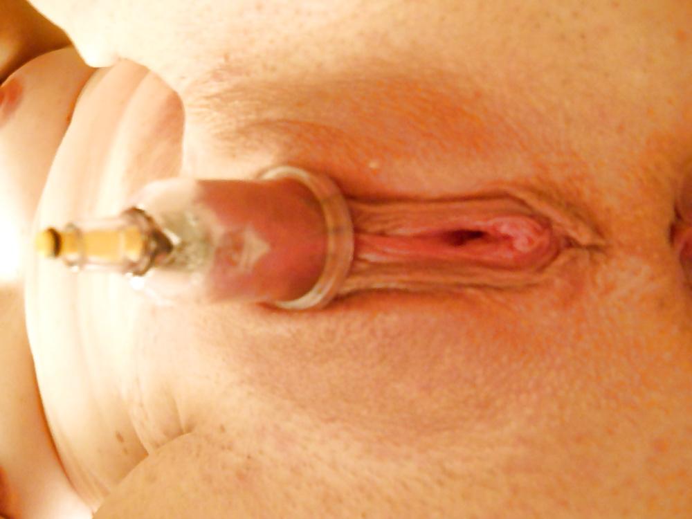 25P Pumped clit n nipples