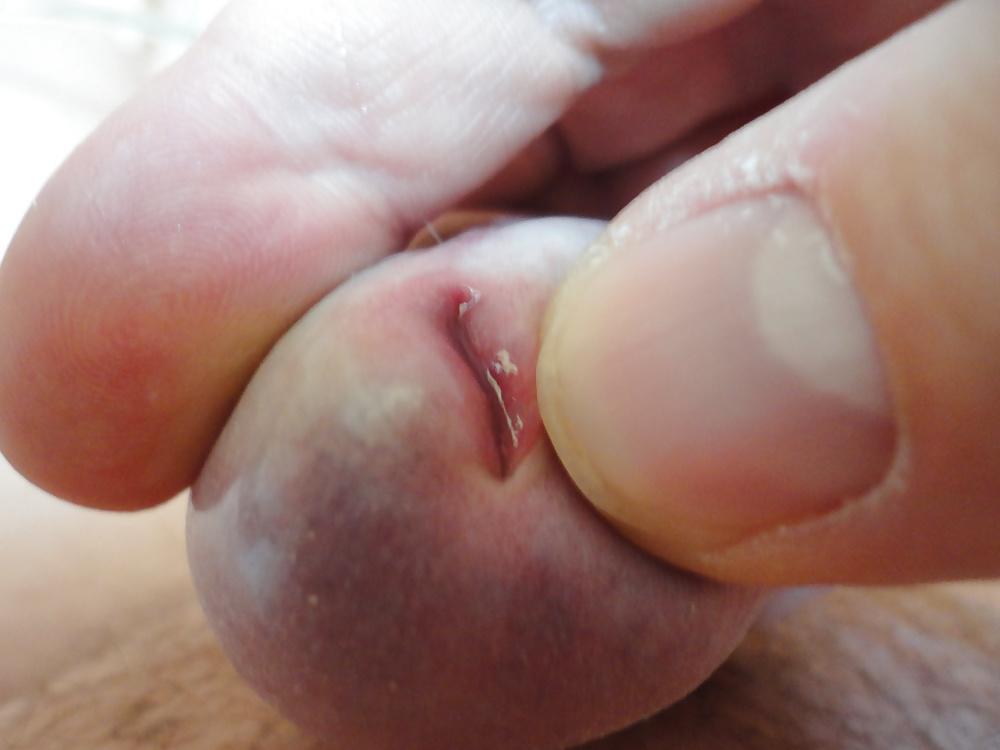 7P CLOSE UP  PEEHOLE  my mein Nille Glied Eichel