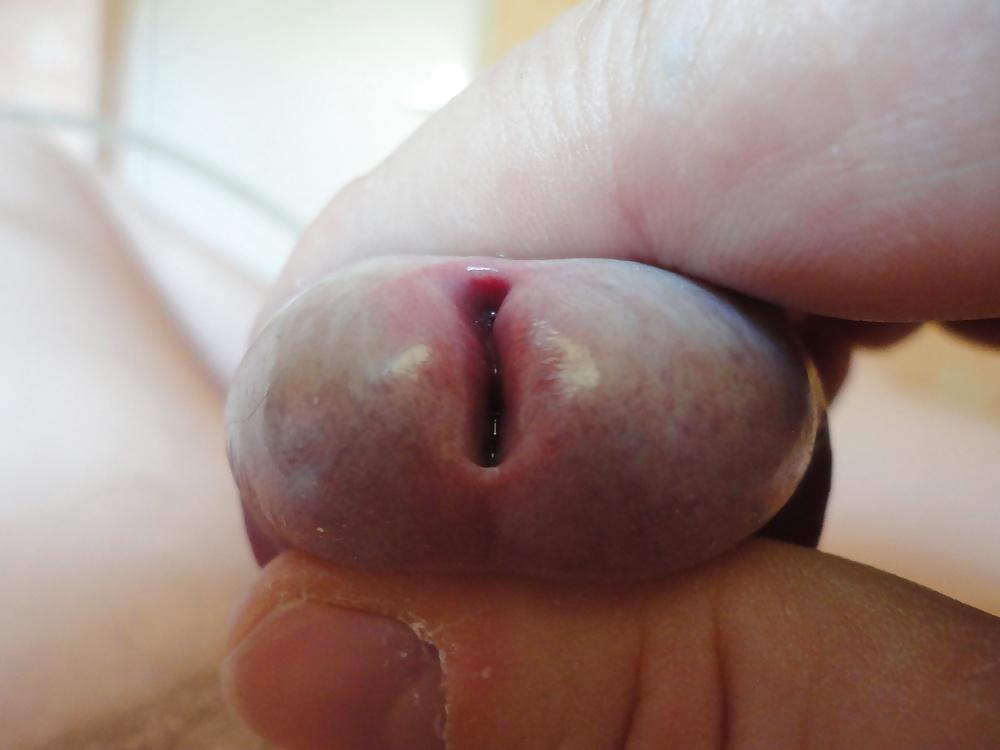 7P CLOSE UP  PEEHOLE  my mein Nille Glied Eichel