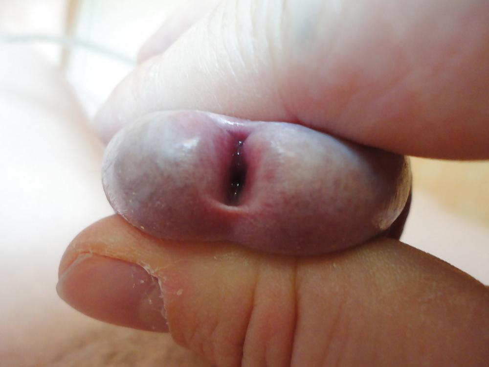 7P CLOSE UP  PEEHOLE  my mein Nille Glied Eichel