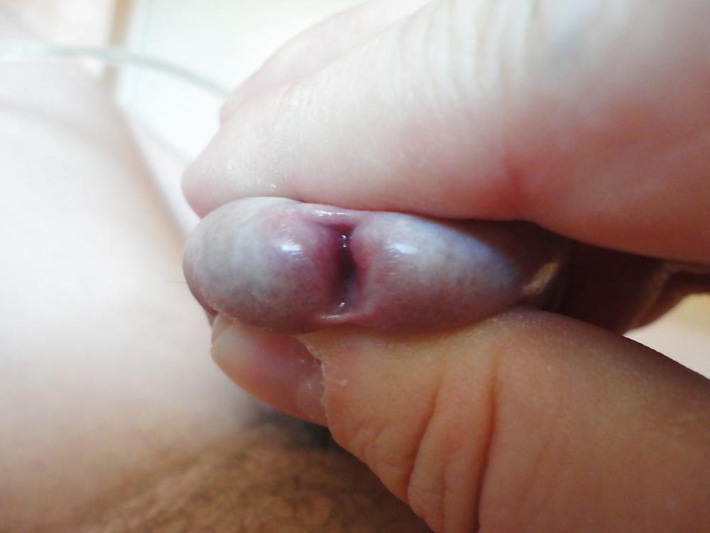 7P CLOSE UP  PEEHOLE  my mein Nille Glied Eichel