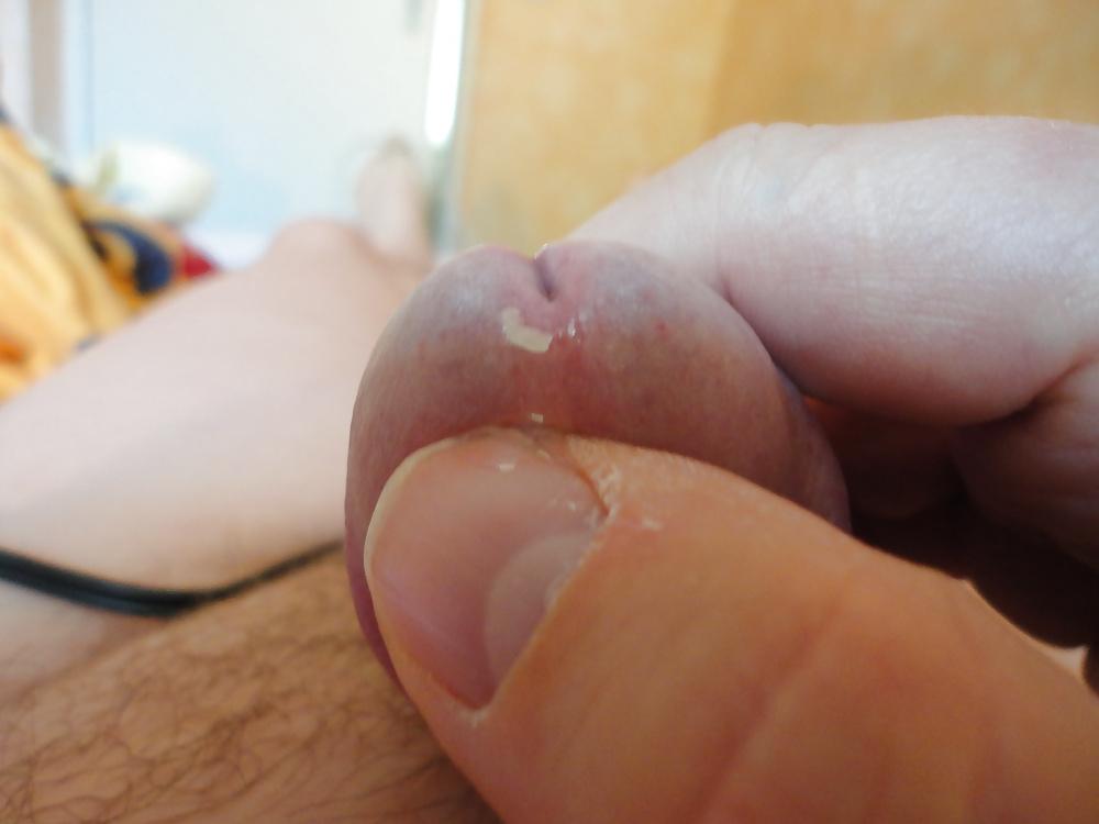 6P CLOSE UP PRECUM   my mein Nille Glied Eichel
