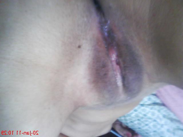 25P Bk  Pussy Close UP