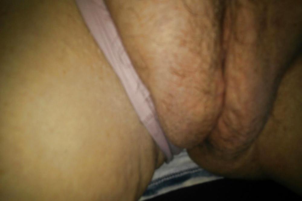 14P Close-up