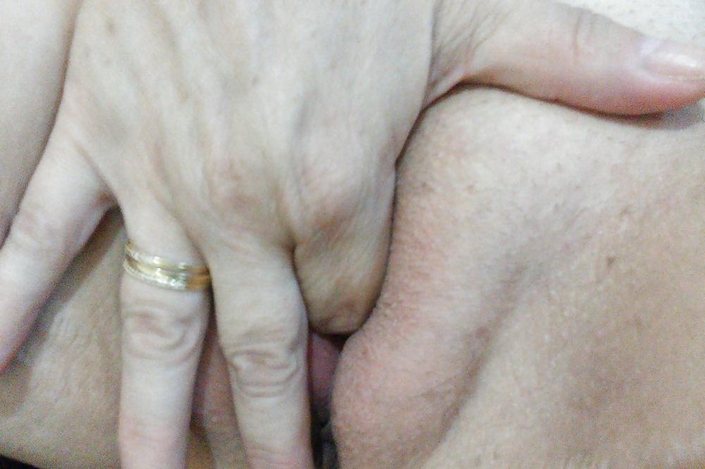 14P Close-up