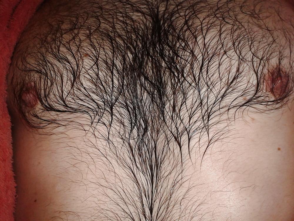 13P Examined male nipples