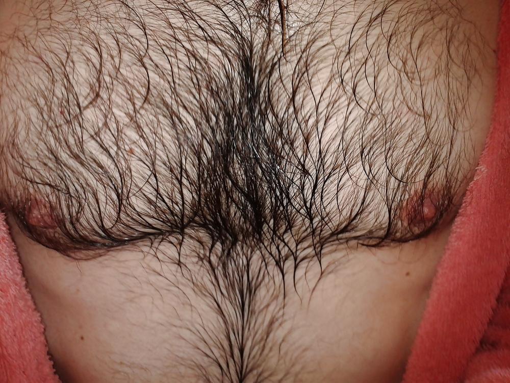 13P Examined male nipples