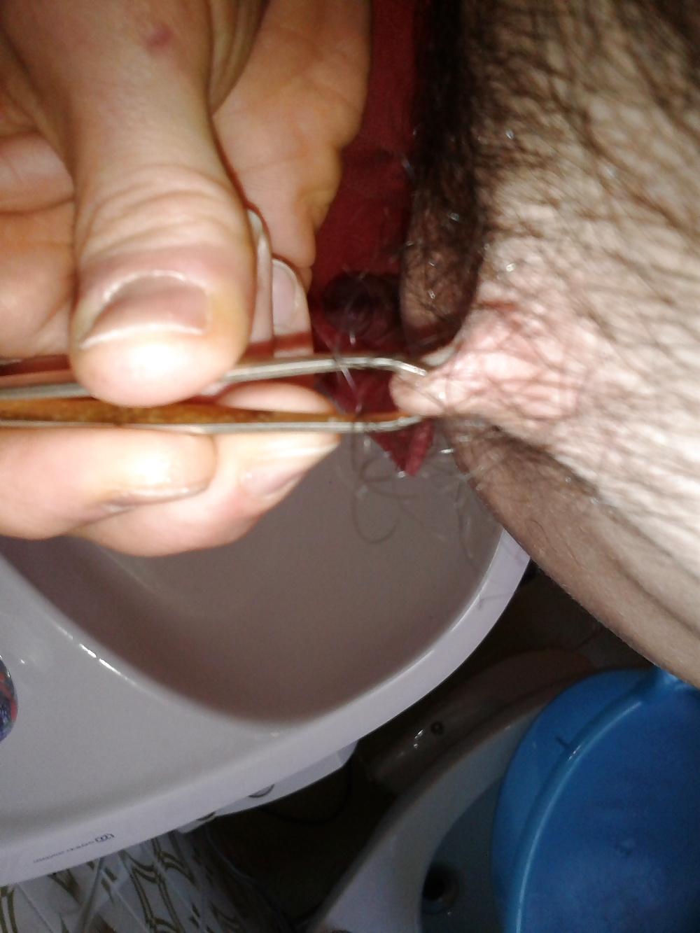 13P Examined male nipples