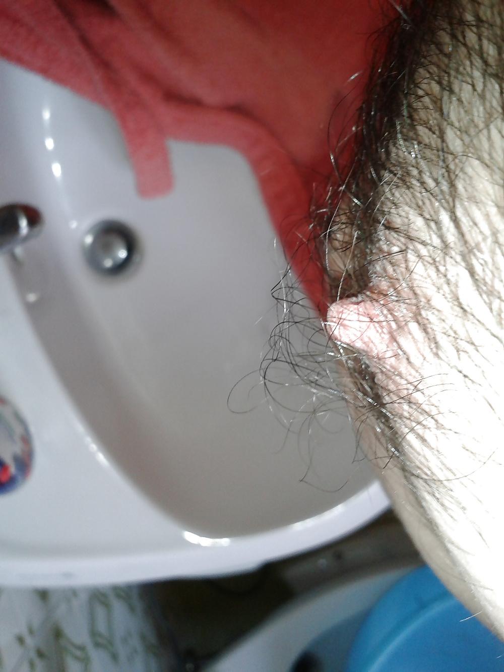 13P Examined male nipples