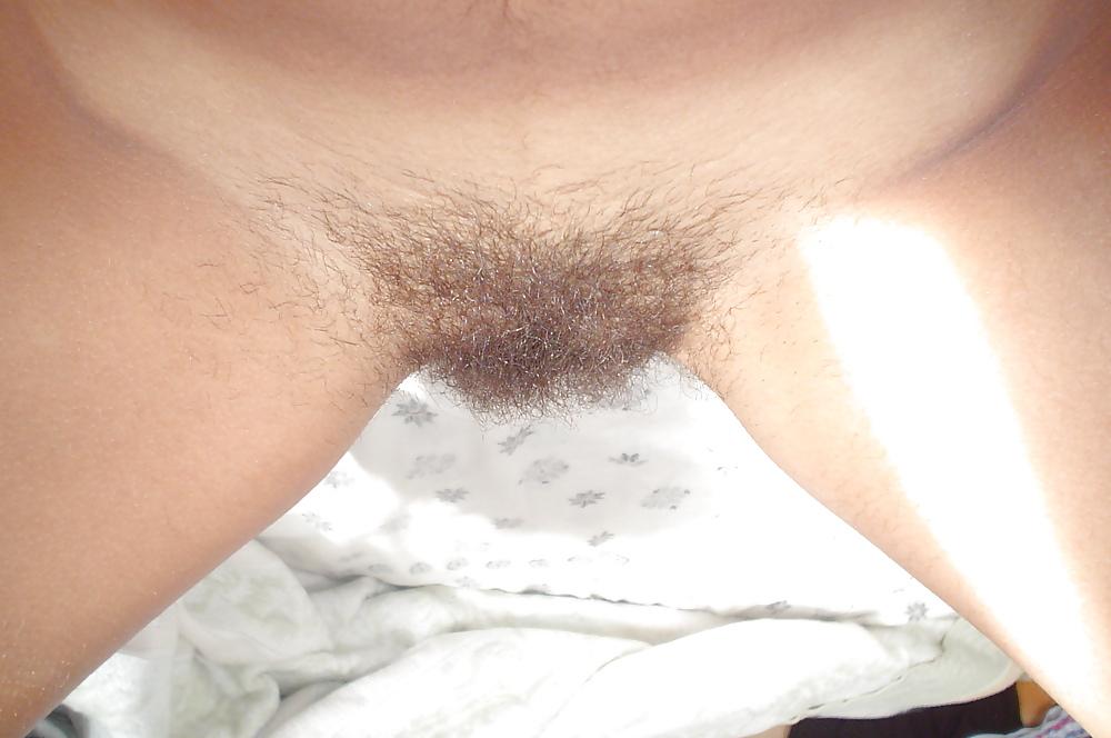 25P Hairy Pics