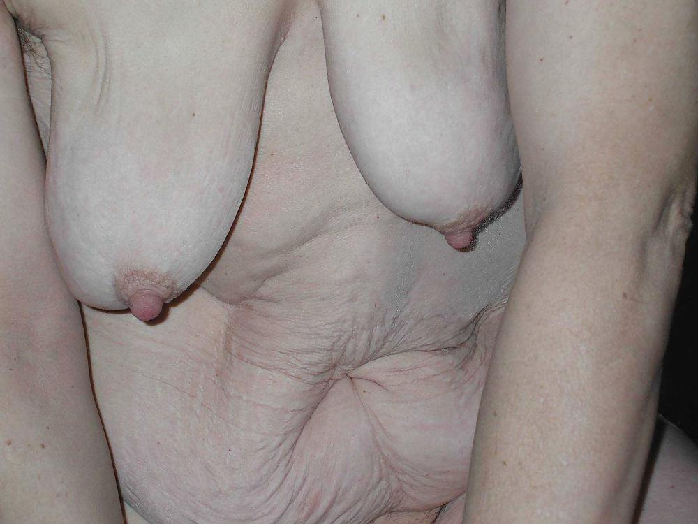 14P Nipples pointing south
