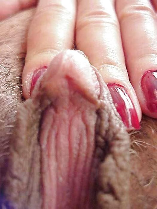 20P Clit - 4