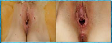 23P Vagina&Pussy