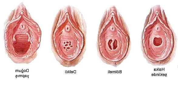 23P Vagina&Pussy