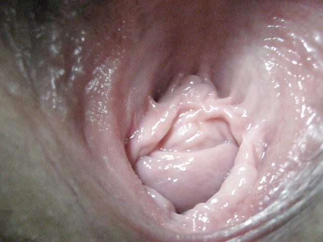 5P Close up....