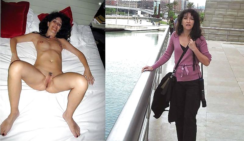 20P Before After 235 (older women special).