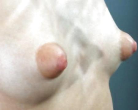 4P Large nipples 