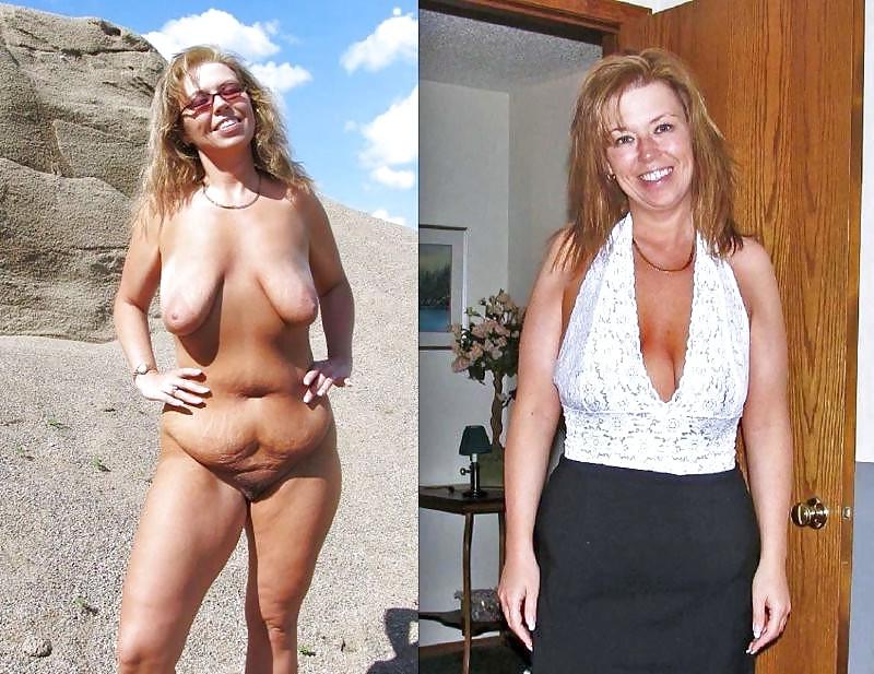20P Before after 332 (older women special).