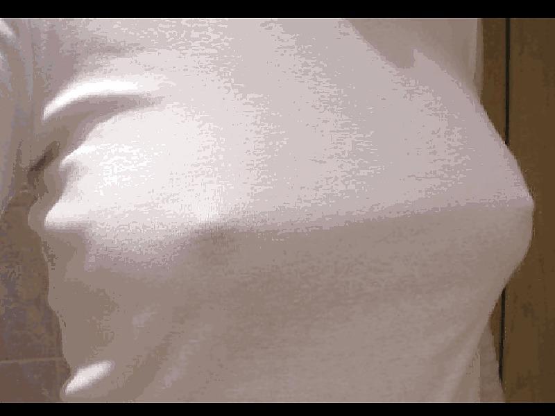 25P Nipples