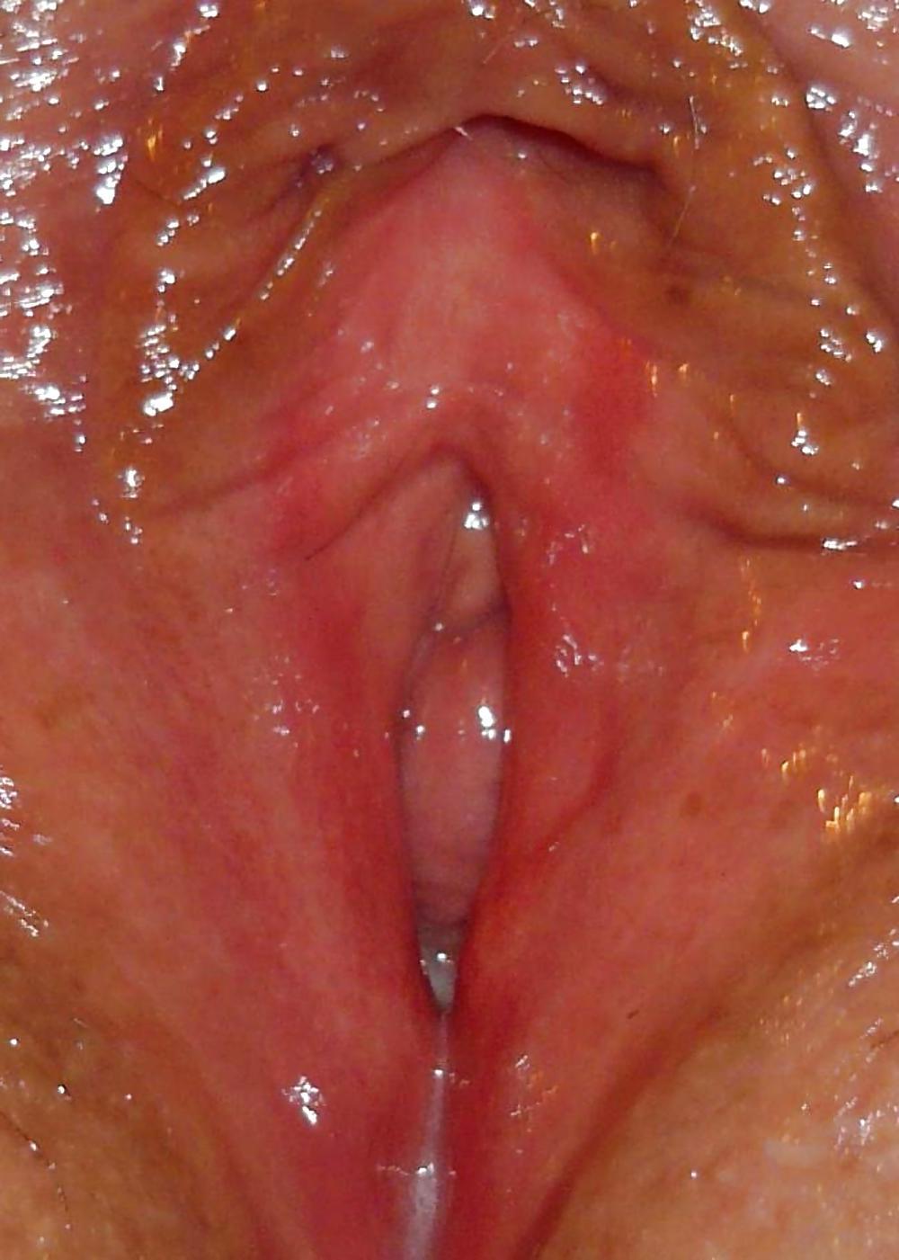 10P Close up