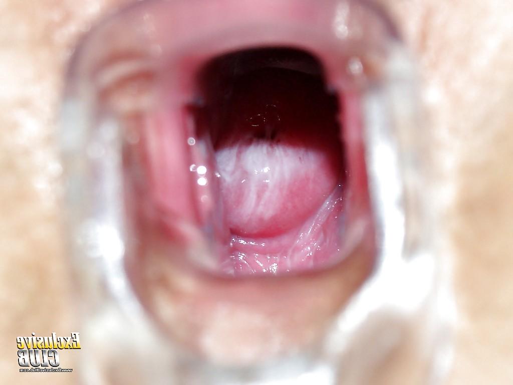 16P Fetish girl in glasses gives her hairy pussy for a look to gyno doc