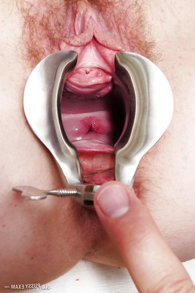 16P Mature lady undergoing hairy pussy examination at gyno office