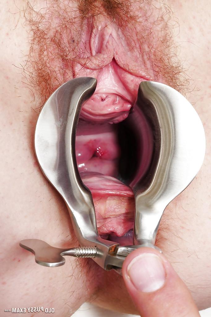 16P Mature lady undergoing hairy pussy examination at gyno office
