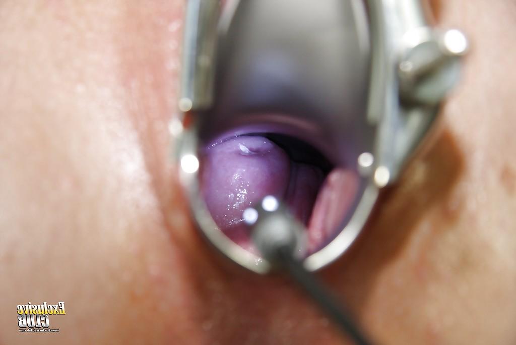 16P Close up doctor check of an formidable babe Alexa Bold with gyno tits