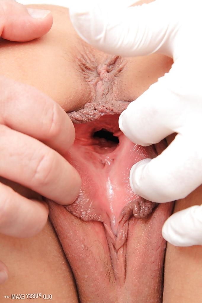 16P Close up check at the doctor features mature fatty Robi Slava