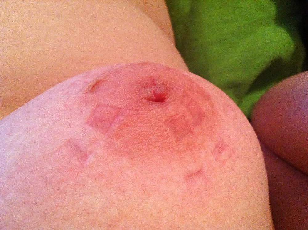 12P Clothes pinned nipples 