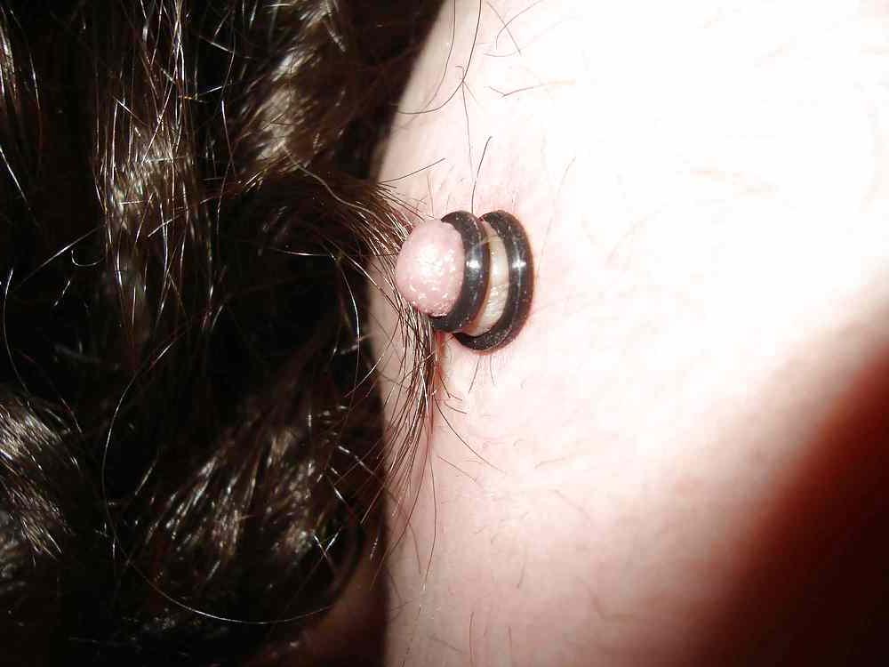 5P Nipples