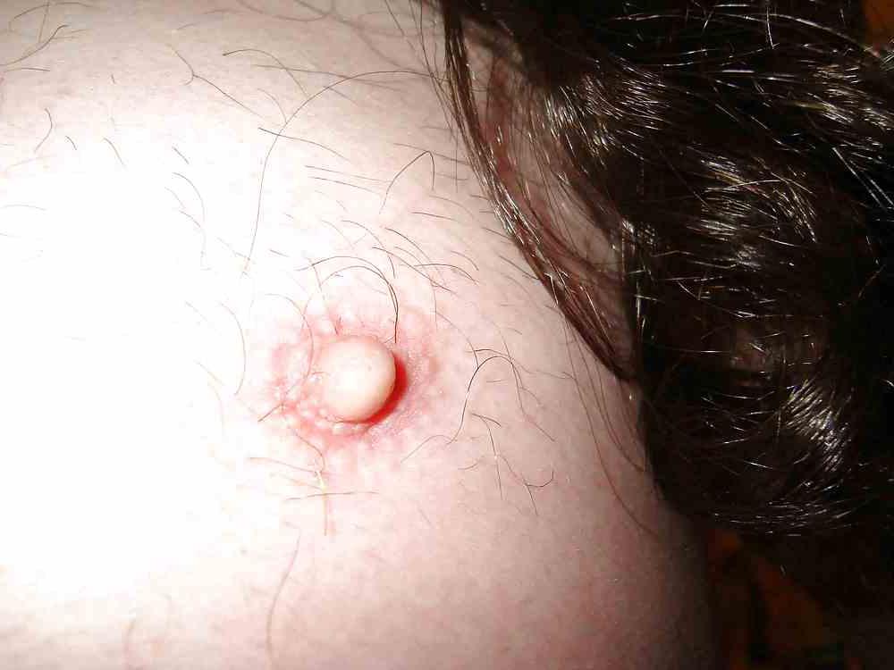 5P Nipples
