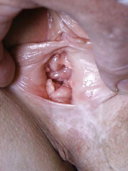 15P Close-up