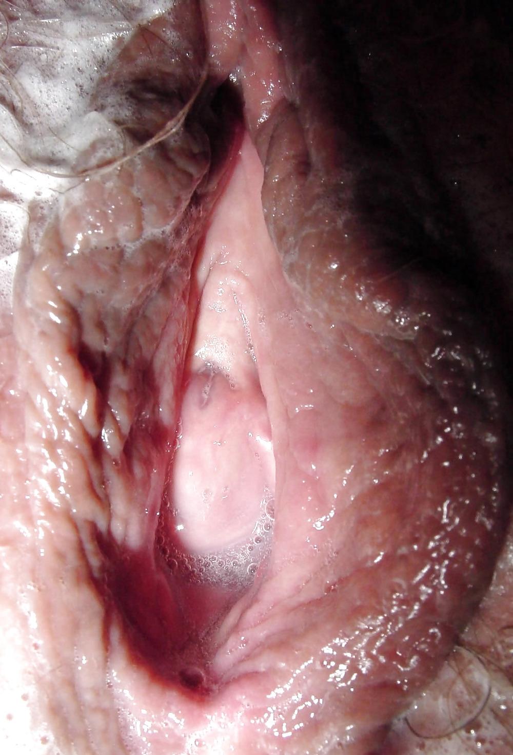 20P Pussy close up