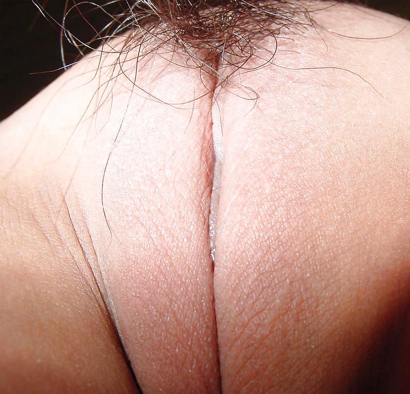 20P Pussy close up