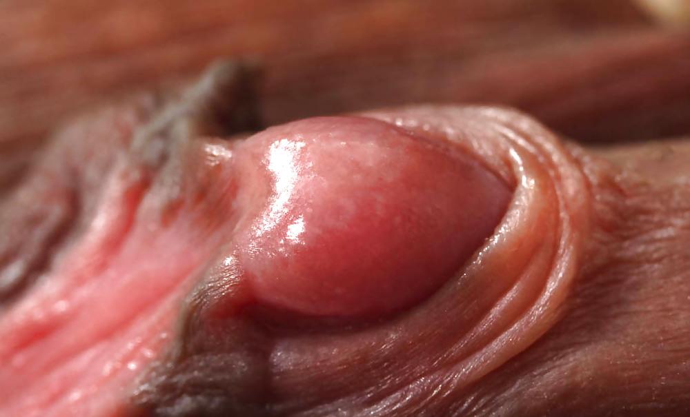 4P CLIT