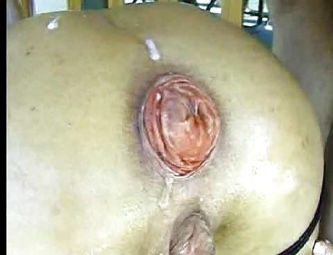 7P Ayla Mia in threesome rectal prolapse
