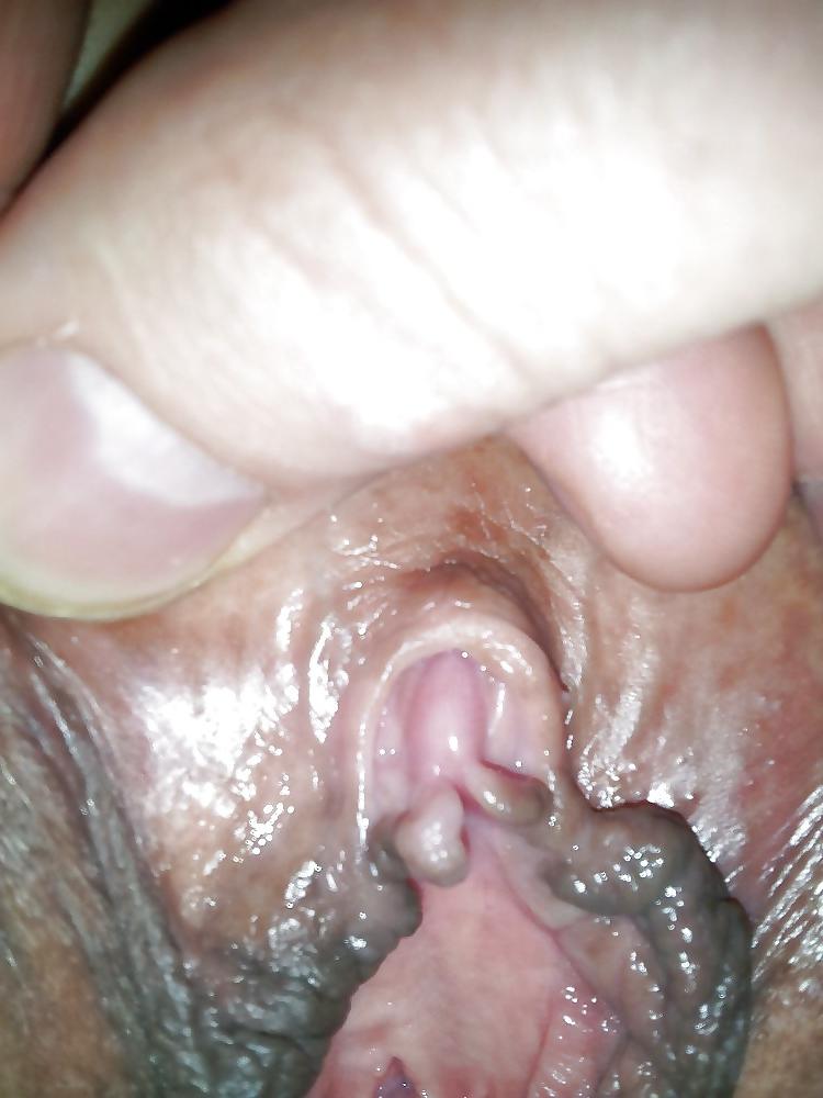 11P Lips and clit