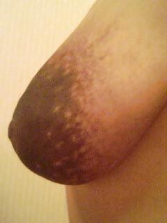 10P Interesting Asian Nipples & Areolas