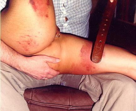 20P Vintage spanking and bruising beating of retro fetish model Ra